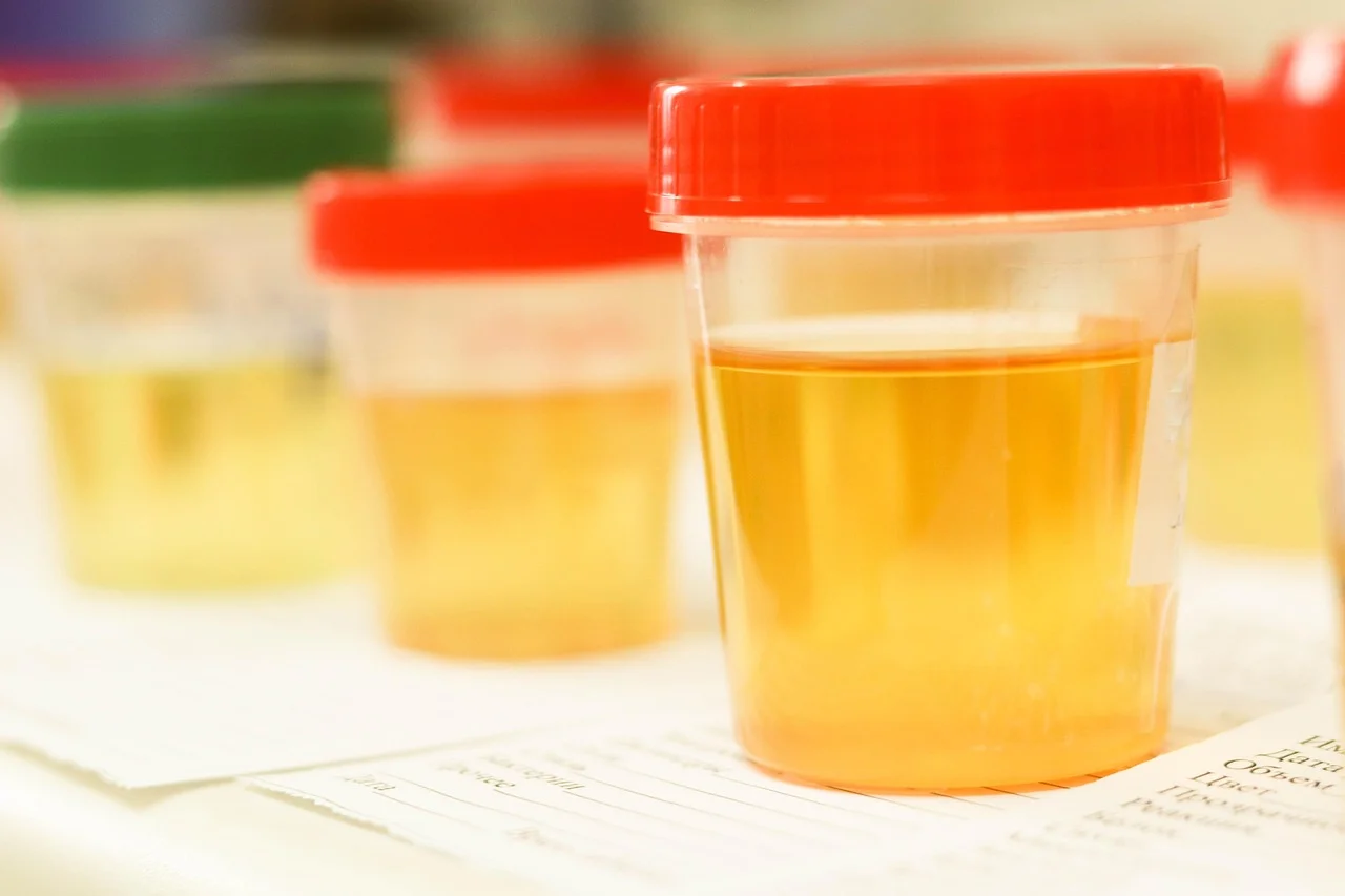 Urinare spesso significa sempre prostata ingrossata? Perché il sintomo non identifica da solo la causa